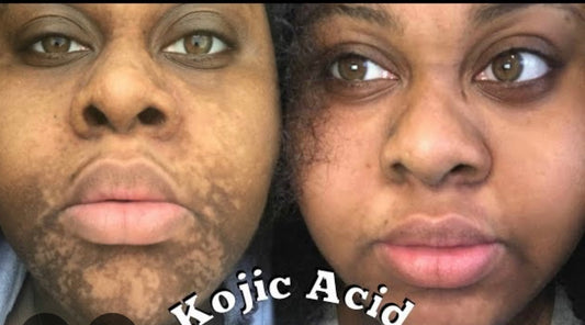 Savon Kojie san skin